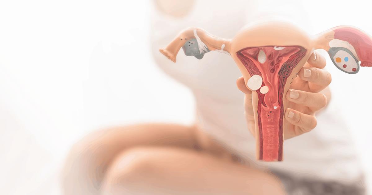[Quais são os exames utilizados para diagnosticar endometriose?]
